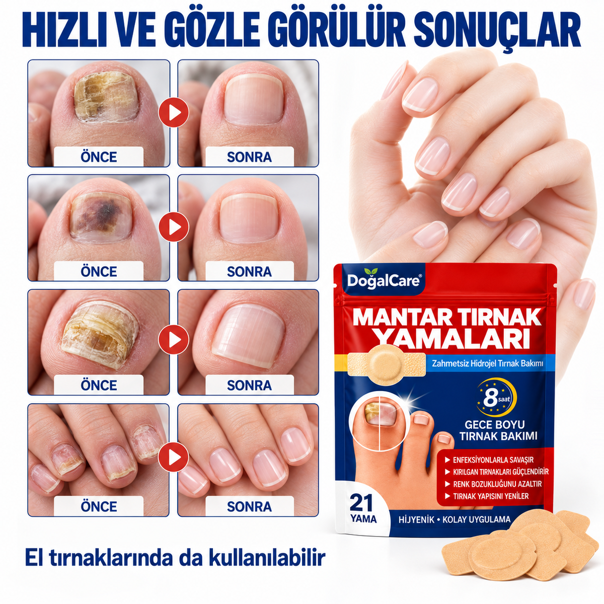 Doğalcare™ Mantar Tırnak Yamaları